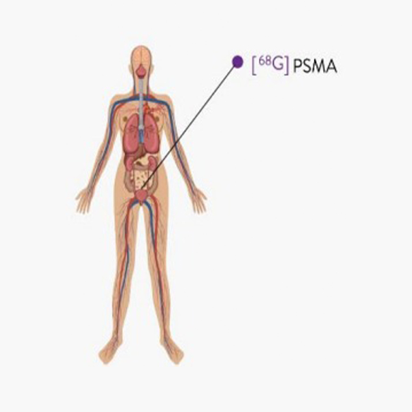 [68Ga]PSMA